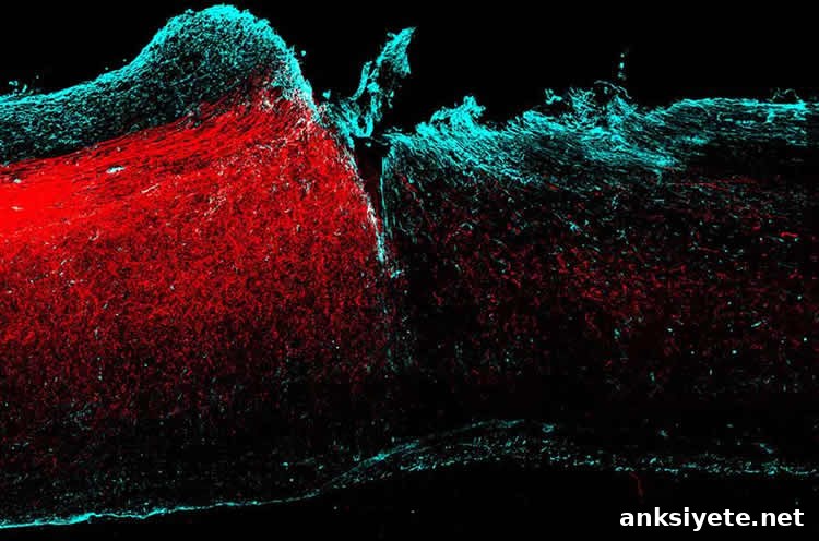 Axons in the motor cortex forming new circuits after spinal cord injury
