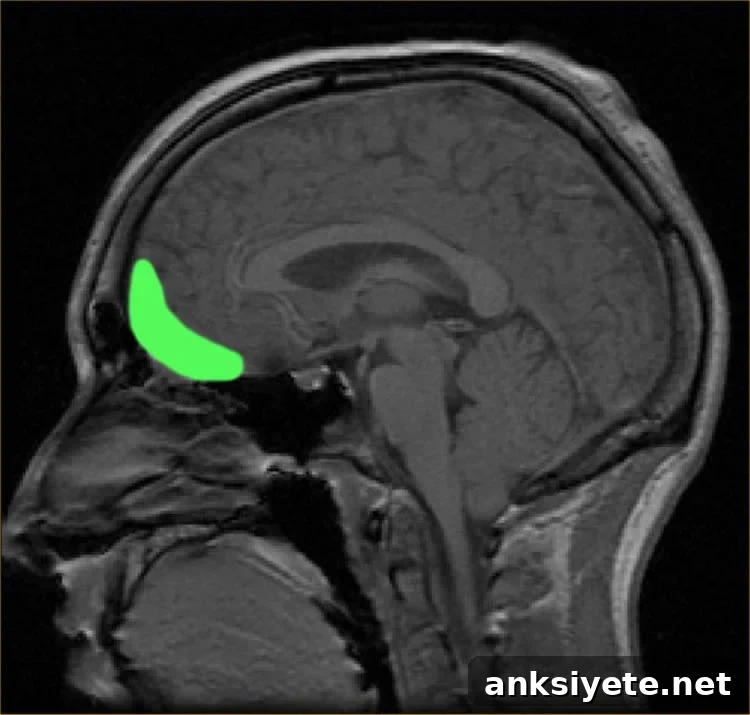 Image shows the location of the orbitofrontal cortex.