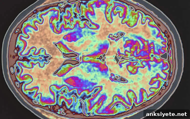 Image shows an MRI scan of the human brain.