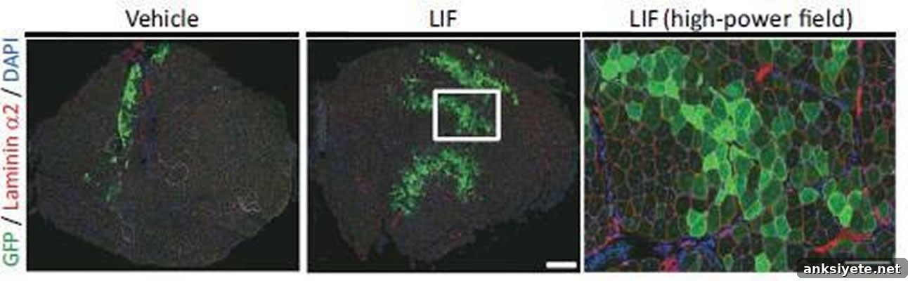 Grow and Transplant Muscle Stem Cells to Treat Muscular Dystrophy 2 Image shows muscle fibers.
