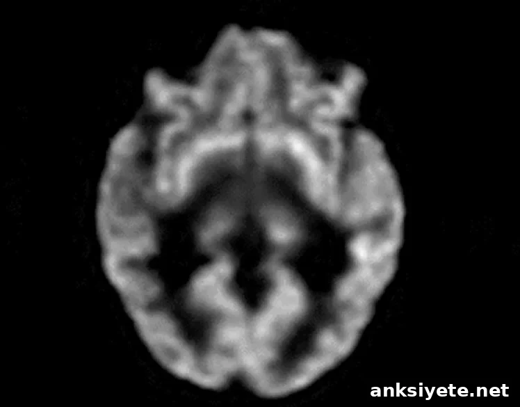 Image shows a brain.