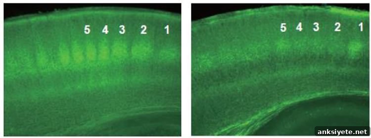 Image shows thalamocortical neurons.