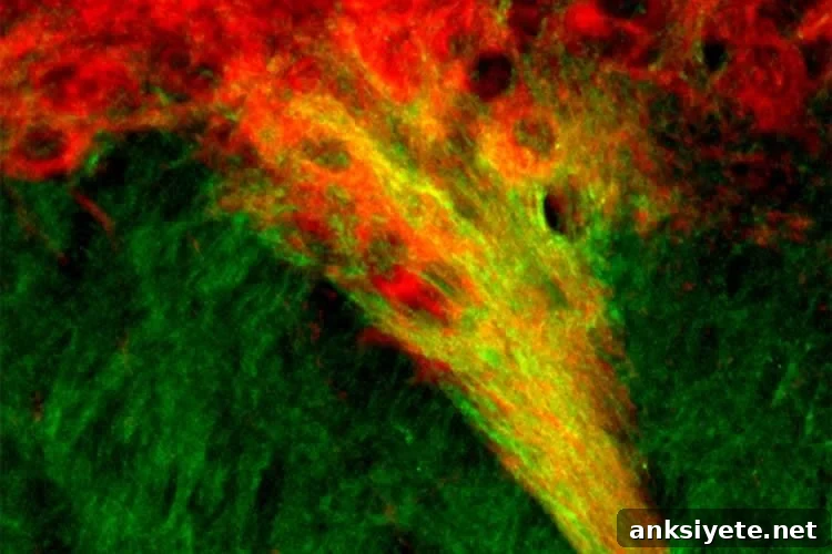 Image shows dopamine producing neurons in the SN.