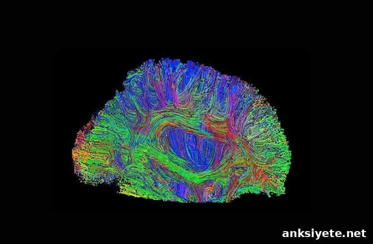 Image shows a brain.
