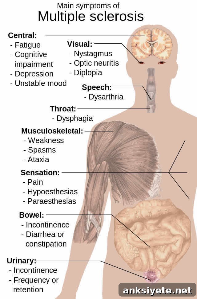 Illustration of how multiple sclerosis affects the body