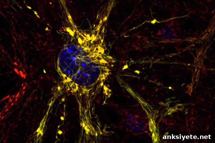 New Treatment Strategy for Charcot-Marie-Tooth Disease 2 Image shows a diseased neuron.