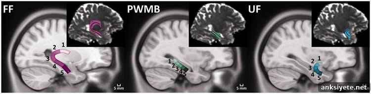 Image shows brain scans.