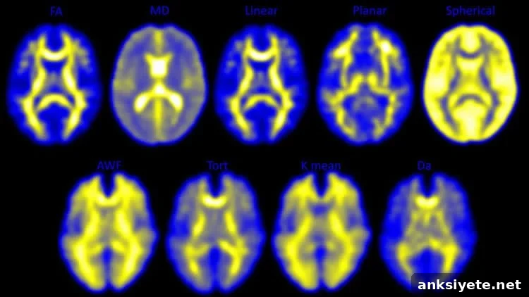 Image shows DTI images of a concussed brain.