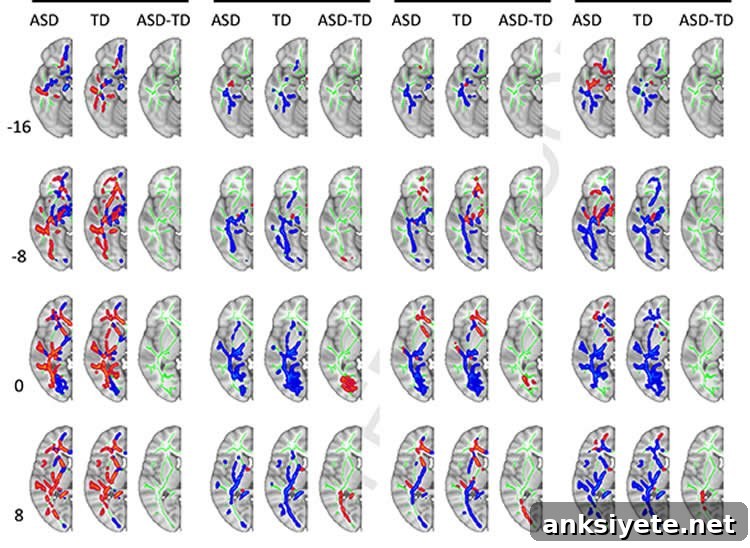 MRI brain scans showing white matter connections