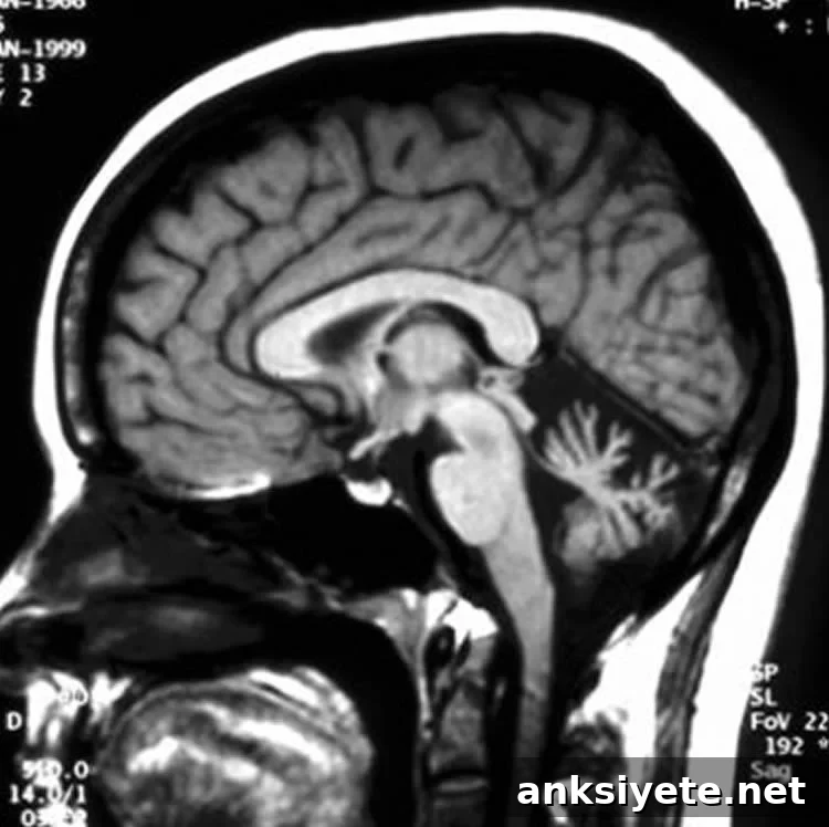 Image shows a brain scan.