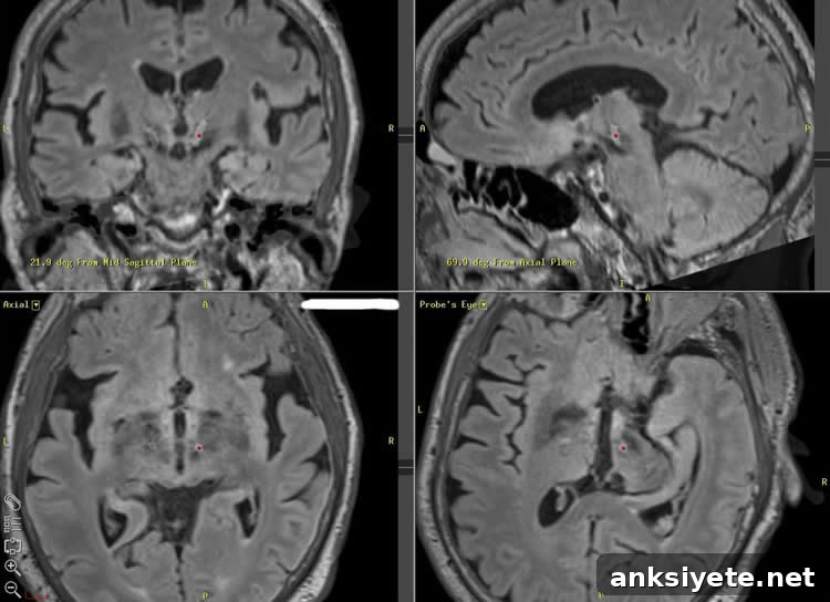 Image shows brain scans.