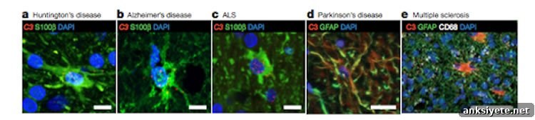 Image shows neurons and astrocytes.