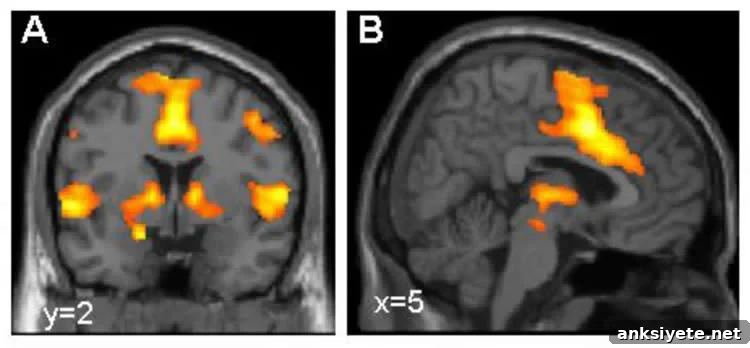 Image shows brain scans with the fear network highlighted in orange.