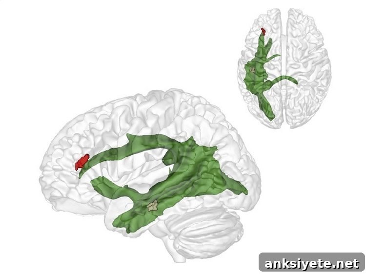 Image shows the locations of the temporal and frontal lobes in the human brain.