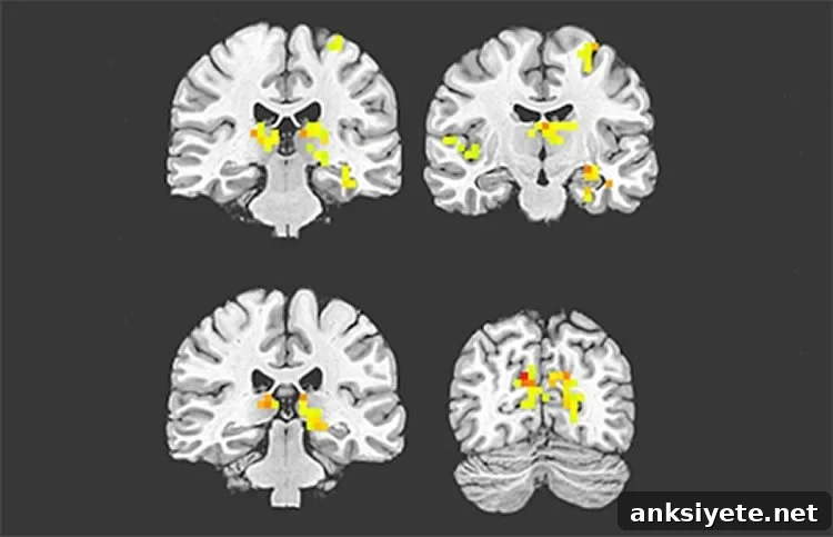 brain scans