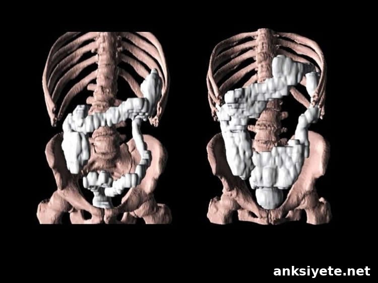 Image shows a gut.