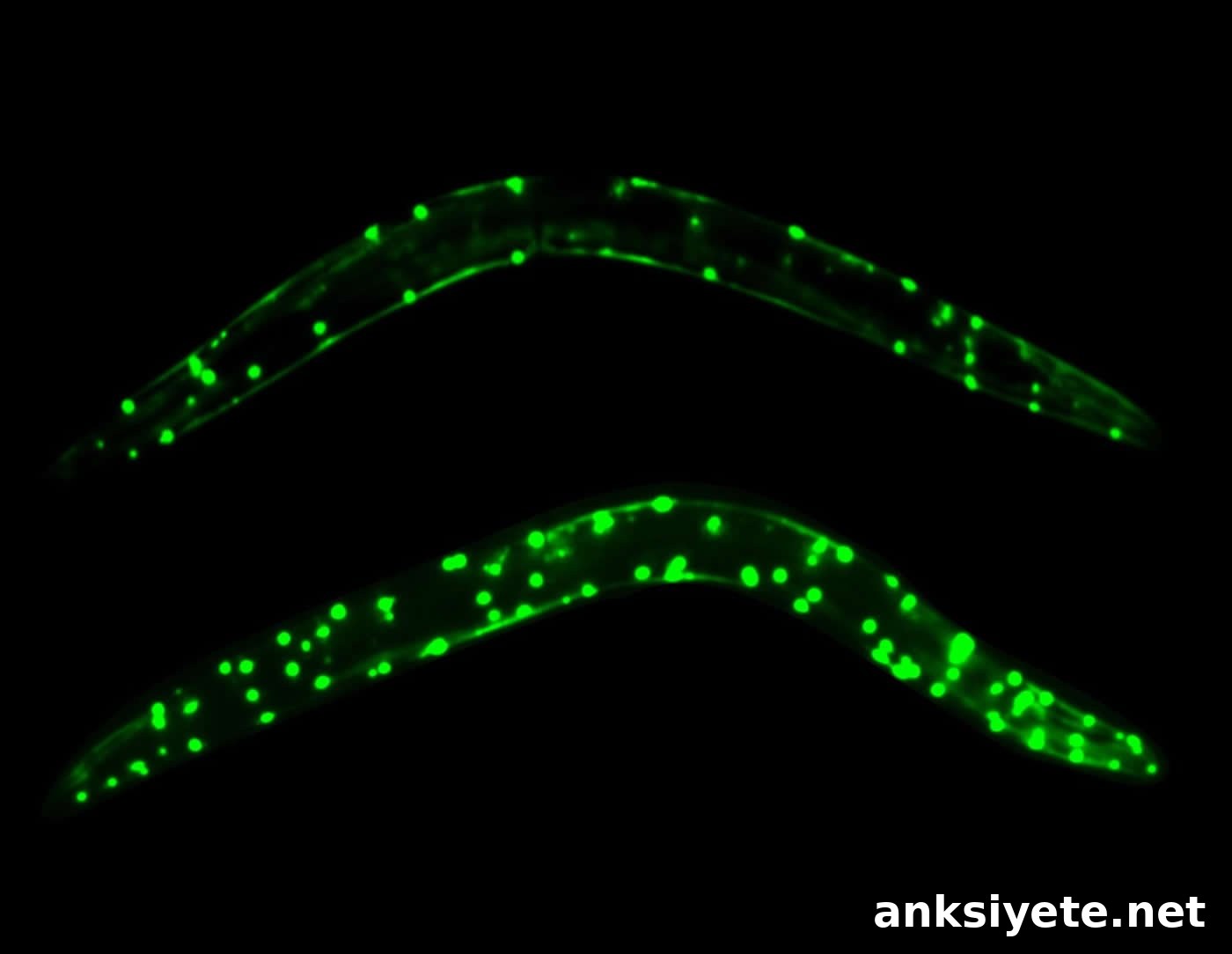 It's Not Just What You Eat: How Gut Microbes Affect You 2 Image shows 2 green worms.