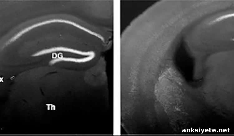 Microscopic image comparing neural stem cell numbers with and without PUM1 and PUM2