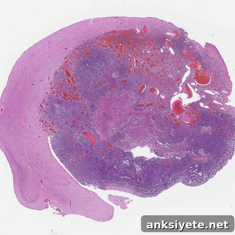 glioblastoma induced by gene-editing