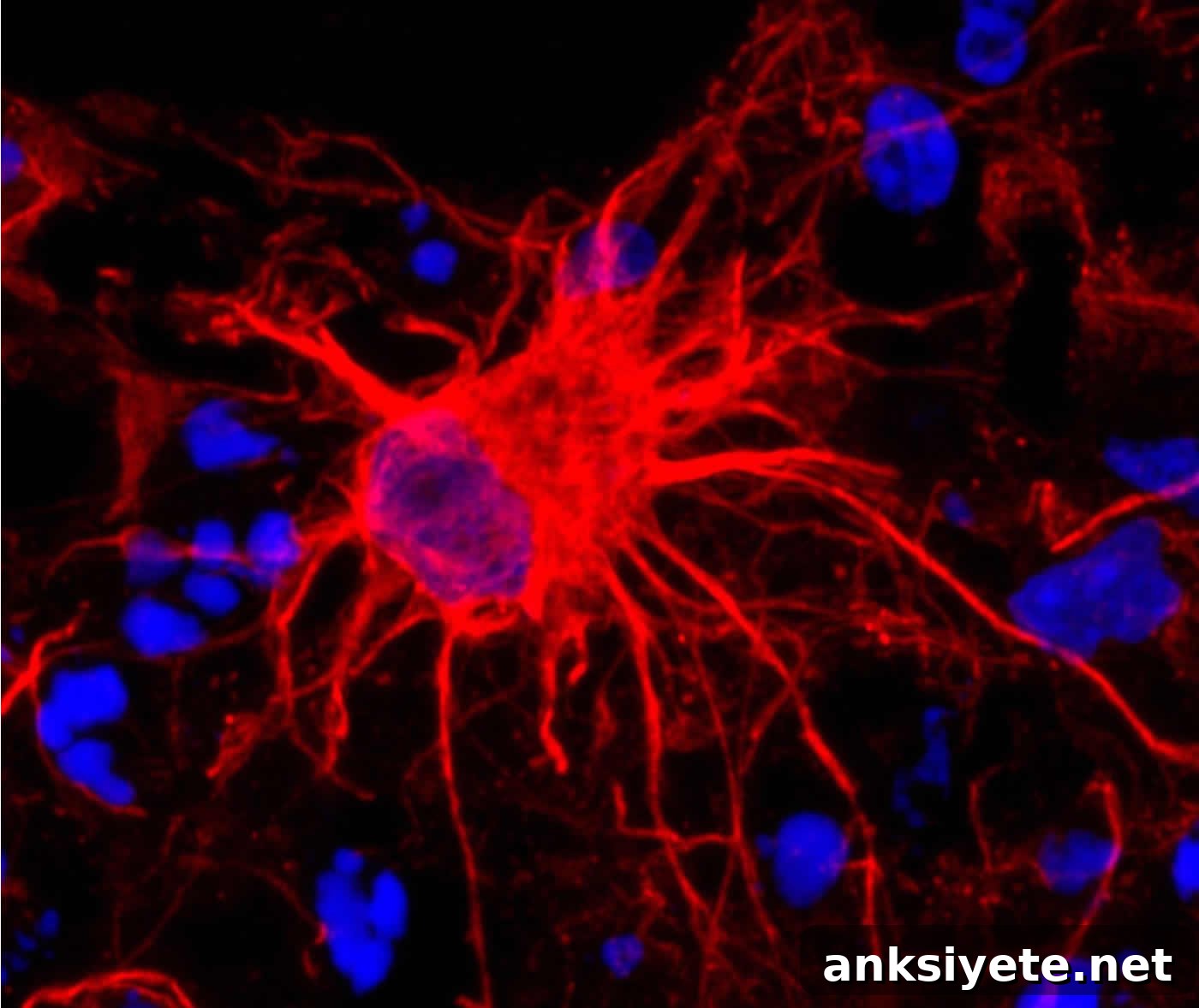 Image shows an astrocyte.