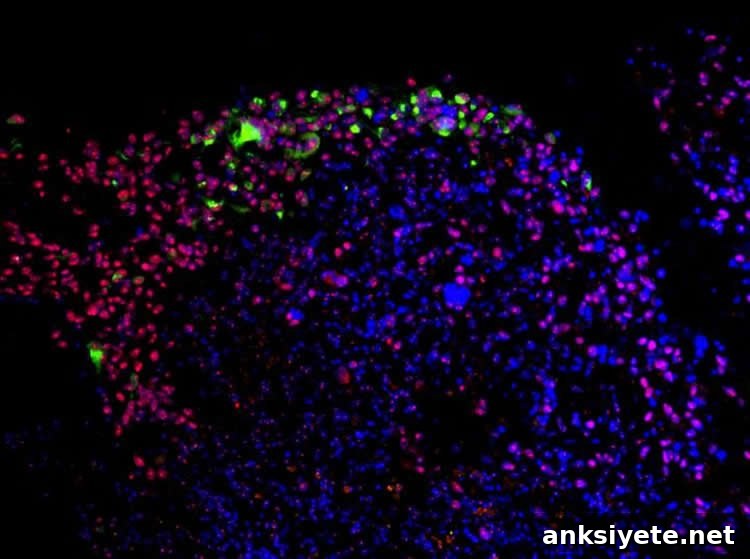 zika virus on glioblastoma.