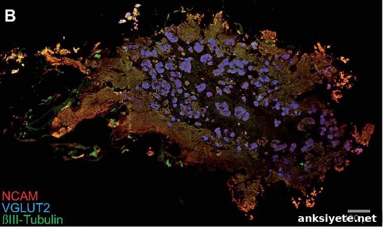 Scientists Identify Cause of Smell Loss in Parkinson's 2 olfaction