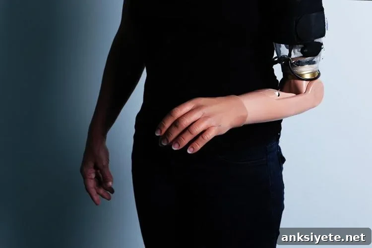 An amputee fitted with an advanced arm prosthetic following TMSR surgery