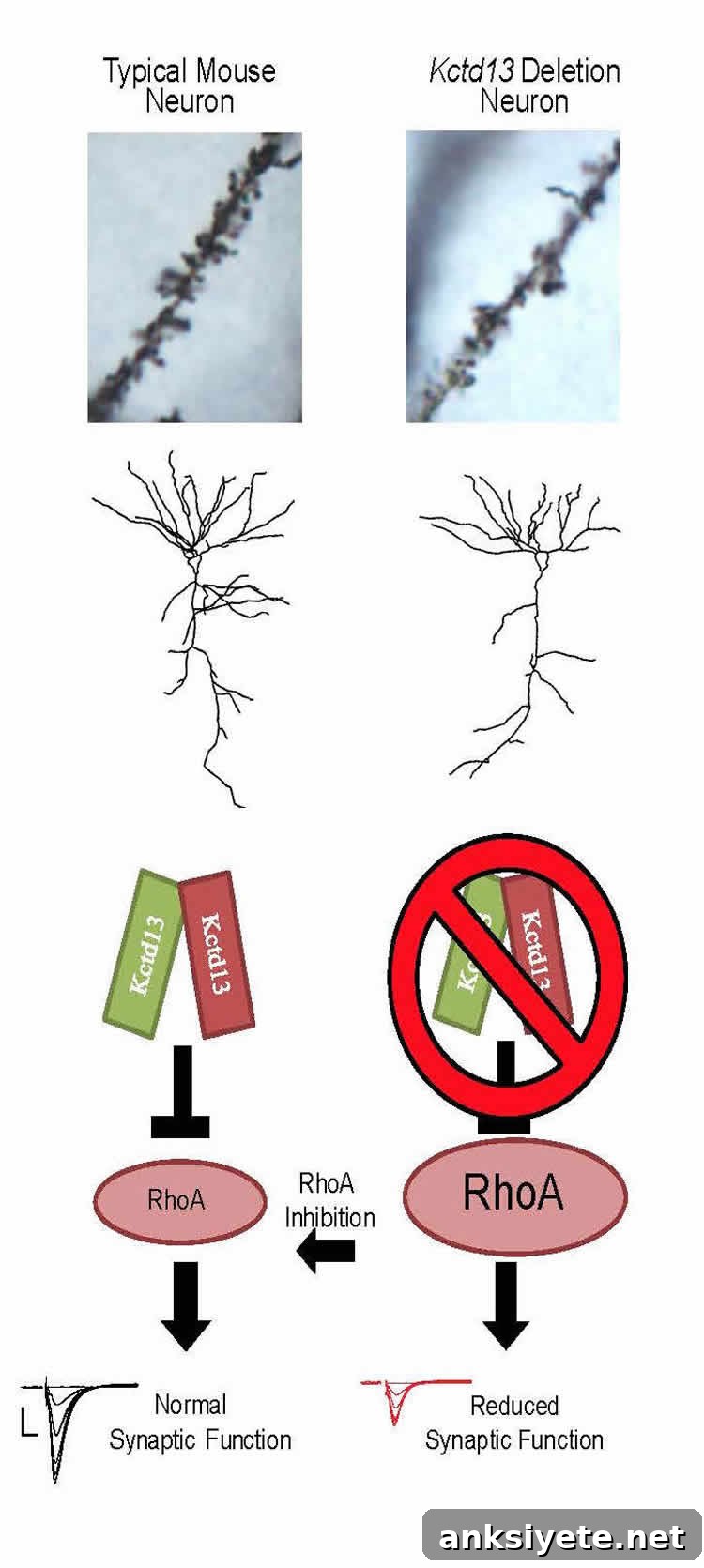 Diagram showing neurons and the effect of KCTD13 presence or absence on synaptic connections