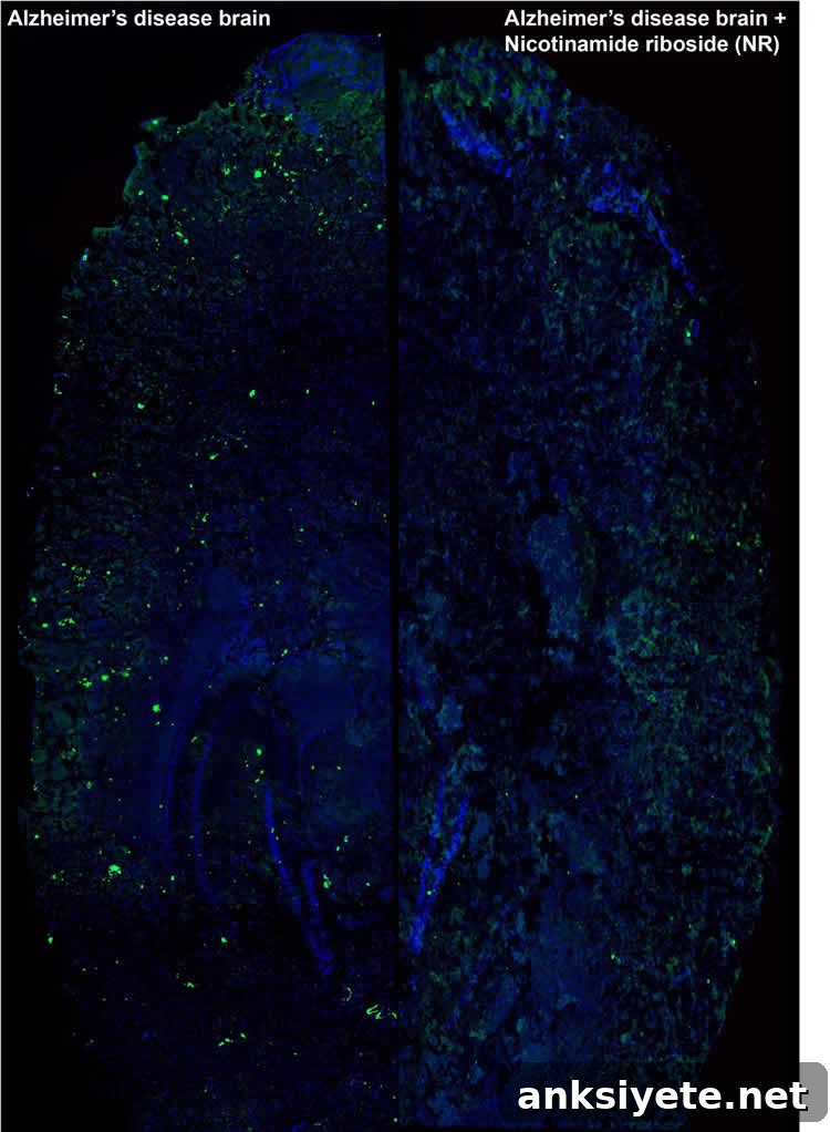 Whole-brain hemisphere sections of Alzheimer’s mice before and after treatment