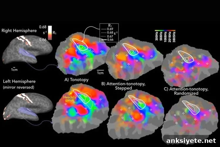 brain scans