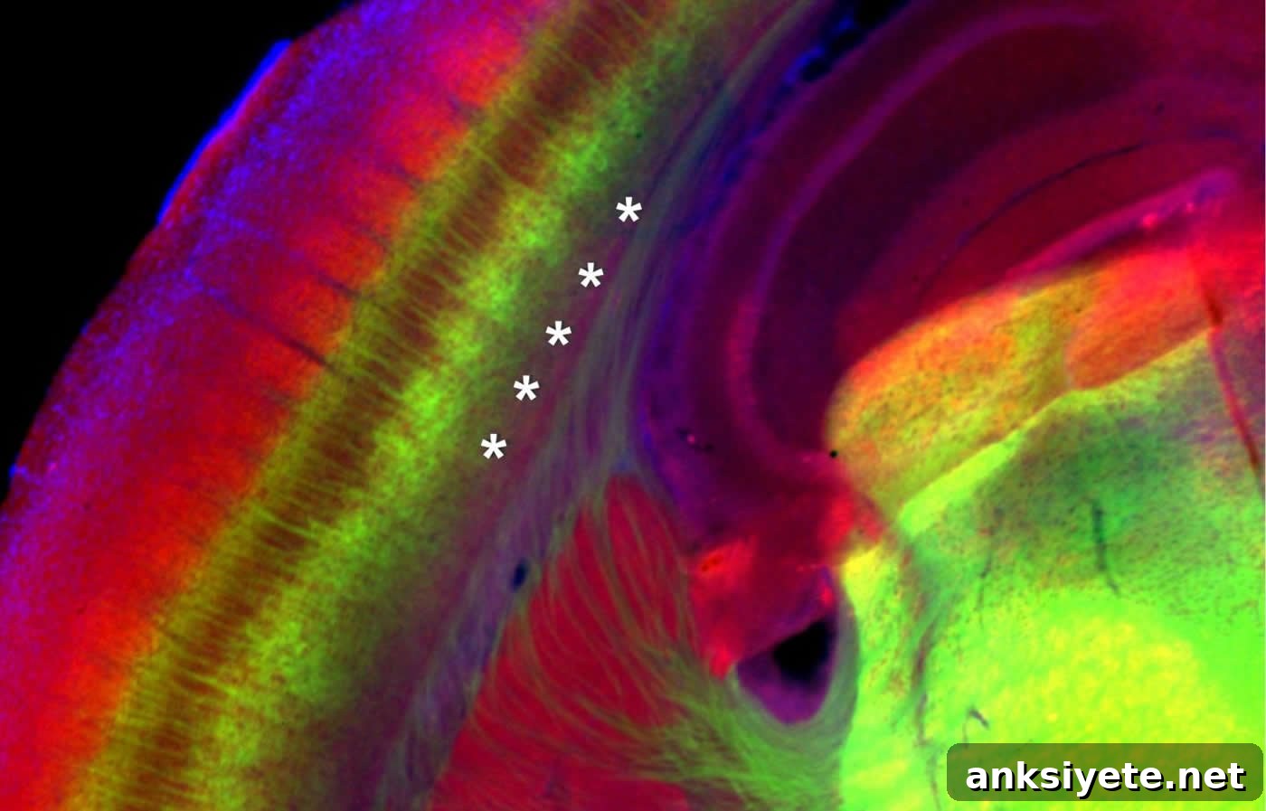 brain slice
