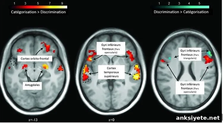 brain scans