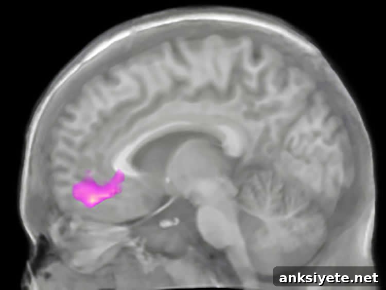 Image shows a brain scan with the VMPFC highlighted.