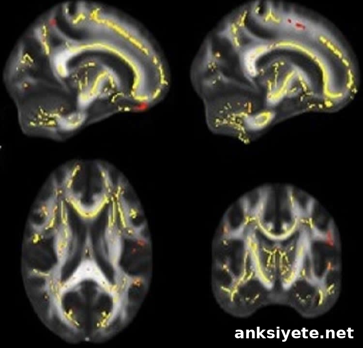 brain scans