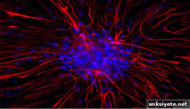 Picture of astrocyte in hippocampus.