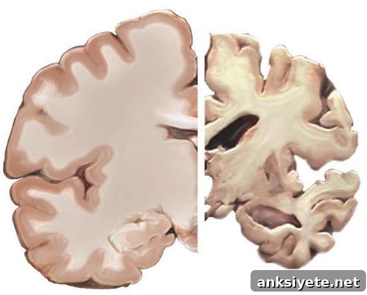 Alzheimers brain slice