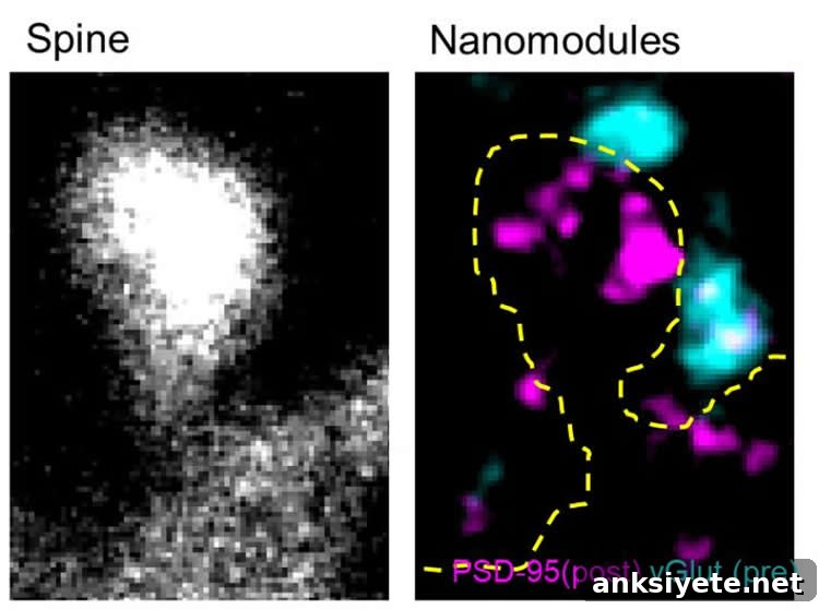 synapses