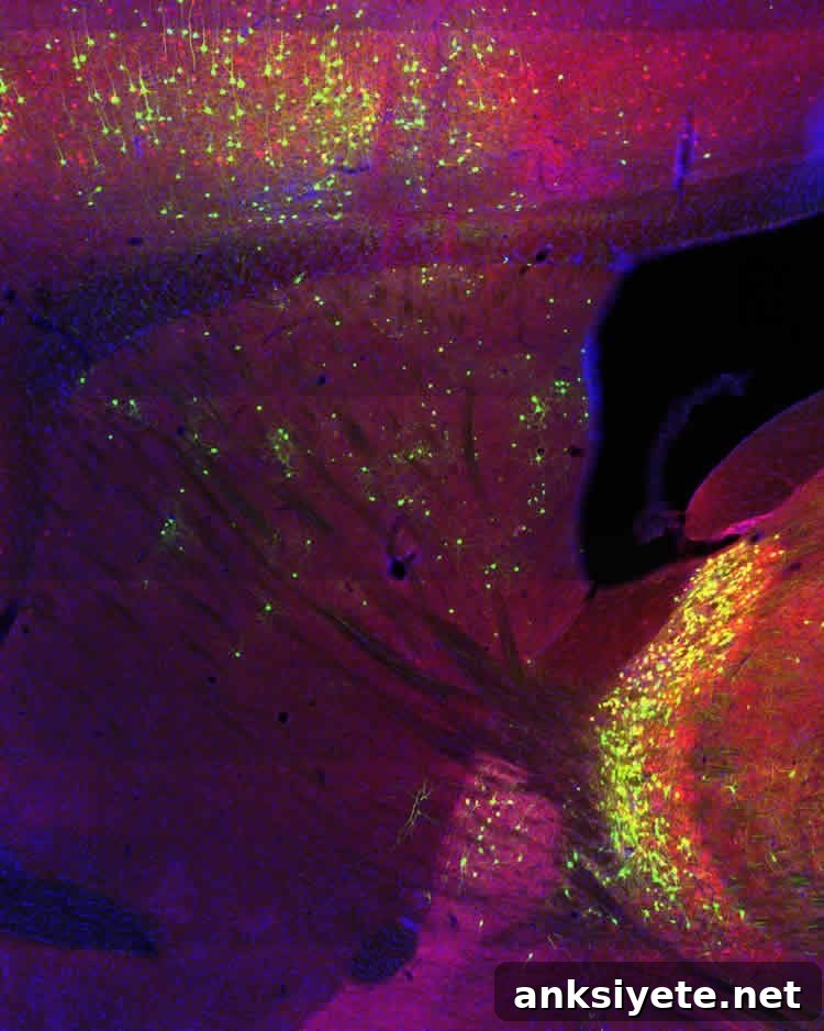 neurons