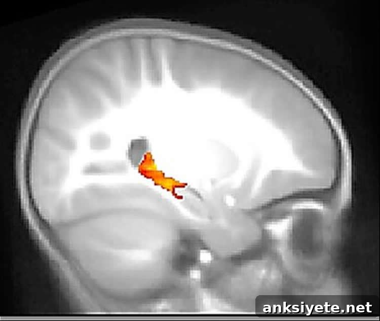 an fMRI scan of a toddler's brain