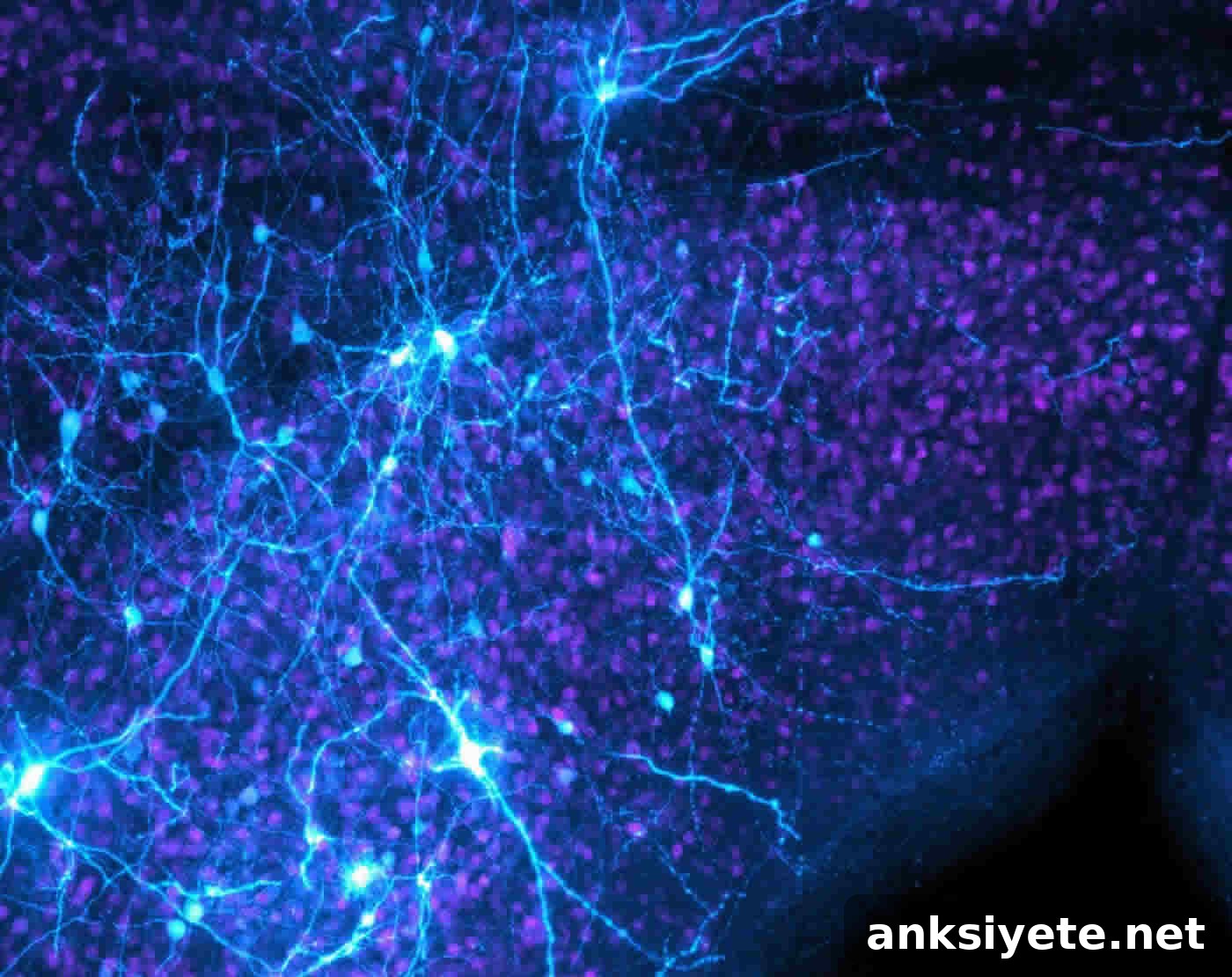 When to Flee: How to Decide If Escape Is Necessary 2 midbrain neurons