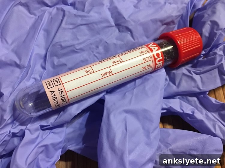 New Metabolic Blood Test May Speed Up Autism Diagnosis 2 a blood vial