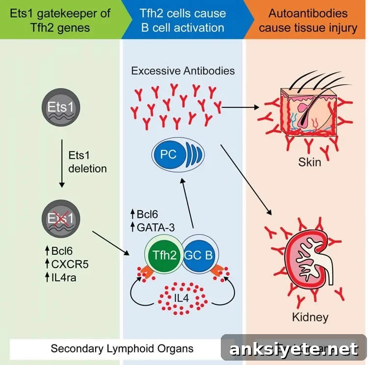 How a Single Gene Mutation Can Cause Lupus 2 diagram