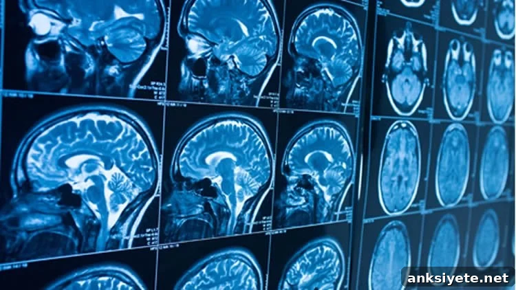 brain scans