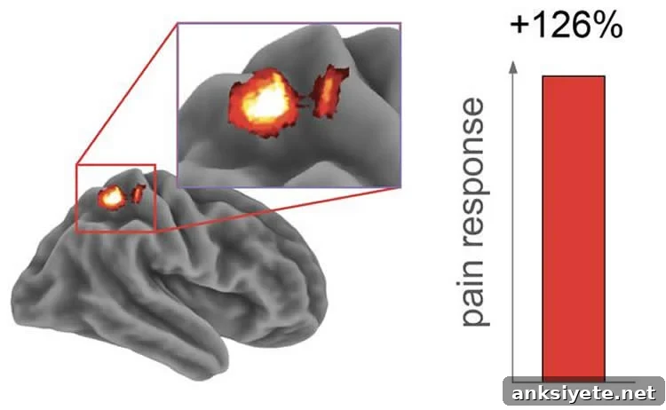 brain scan
