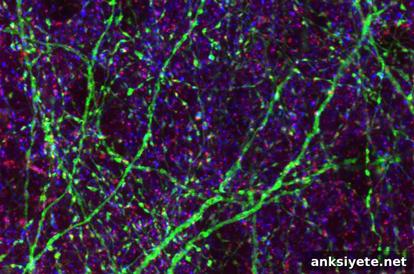 This shows neurons and synapses in purple and green