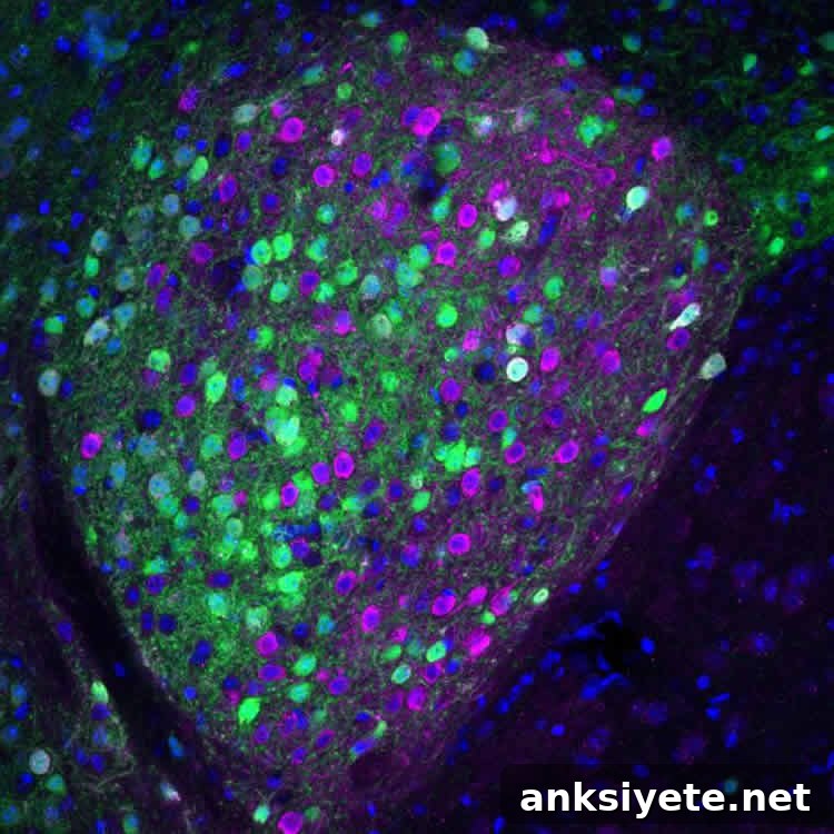 neurons in the CeA are shown
