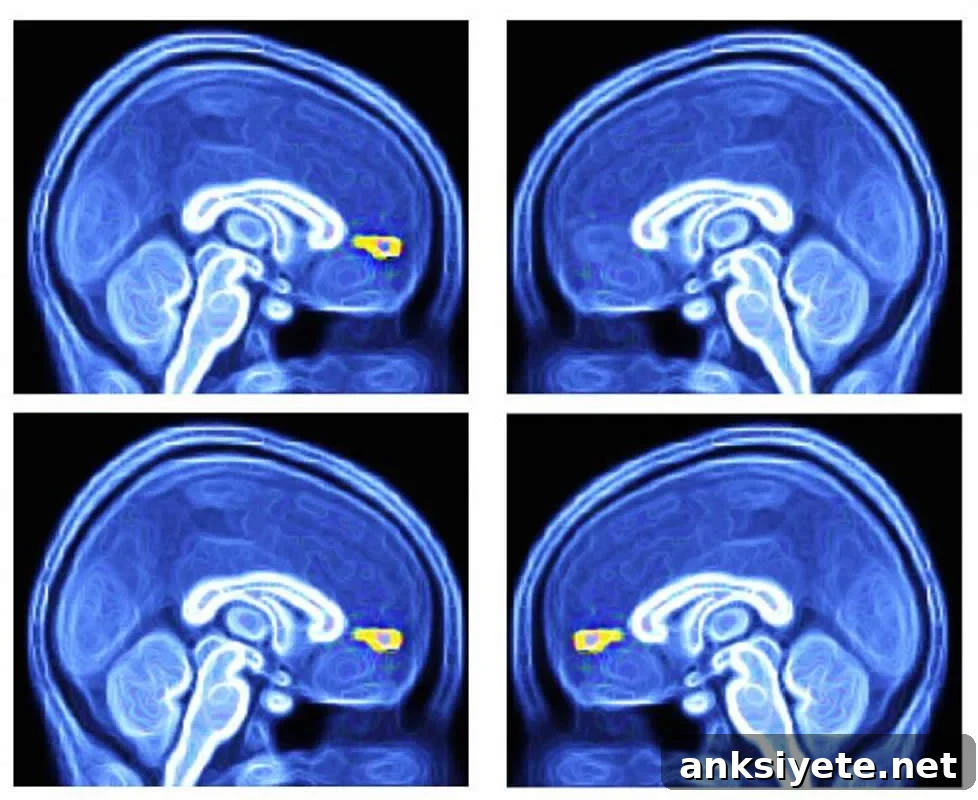 The vmPFC is highlighted in these brain scans