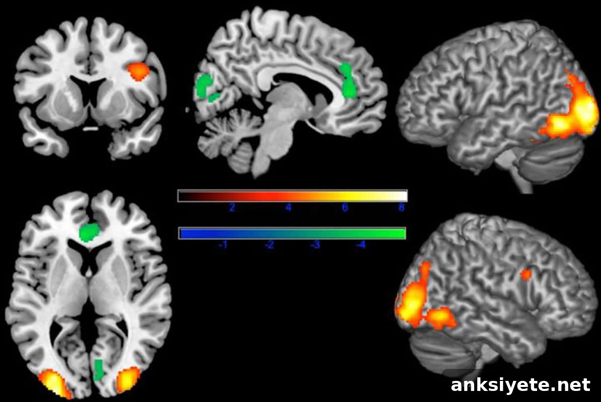 Brain scans showing reduced anterior cingulate cortex activity