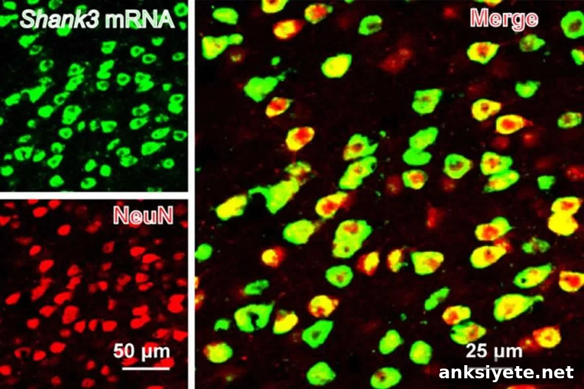 This shows neurons in the ACC
