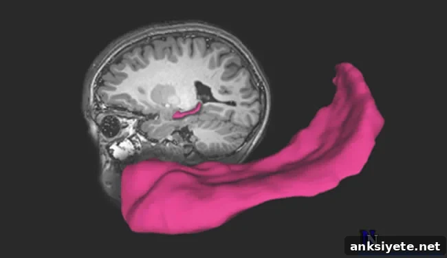 A brain with the hippocampus highlighted is shown.